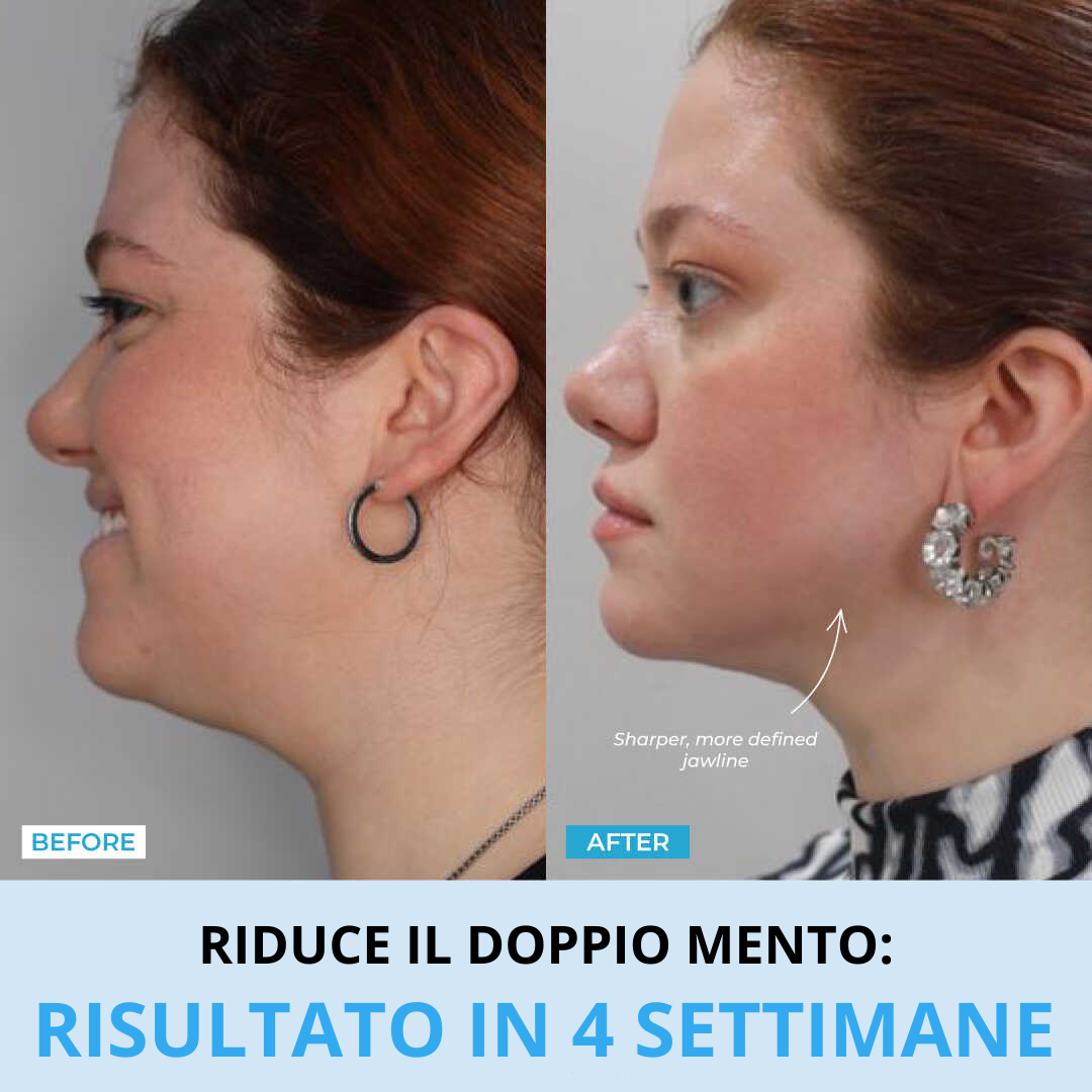 VisoLux – Massaggiatore Viso LED + Siero in regalo